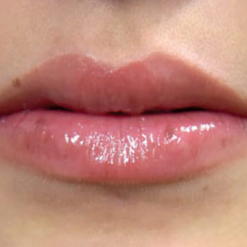 AFTER_lipPlumper