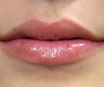 AFTER_lipPlumper