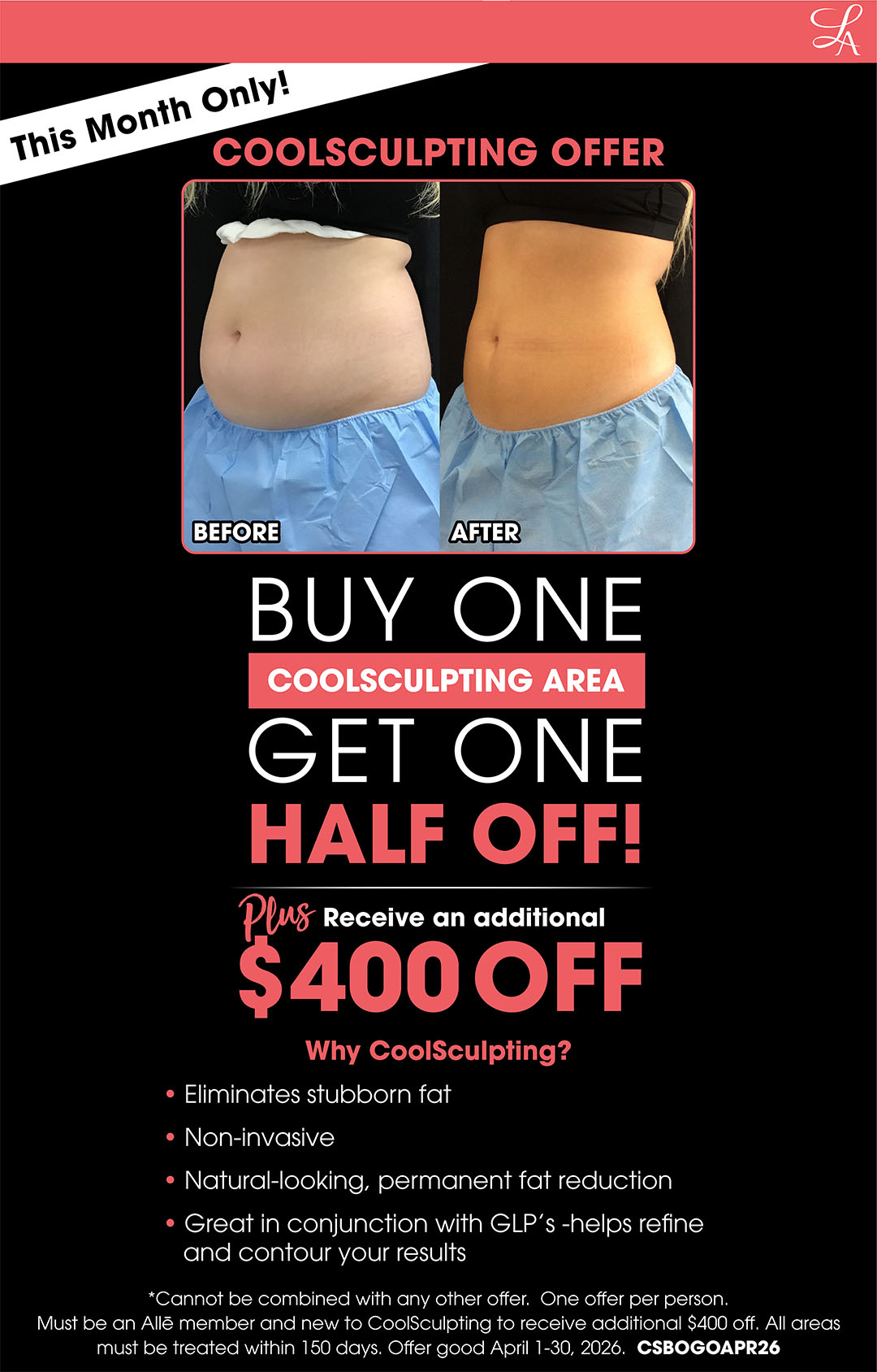 April CoolSculpting Offer Landing page