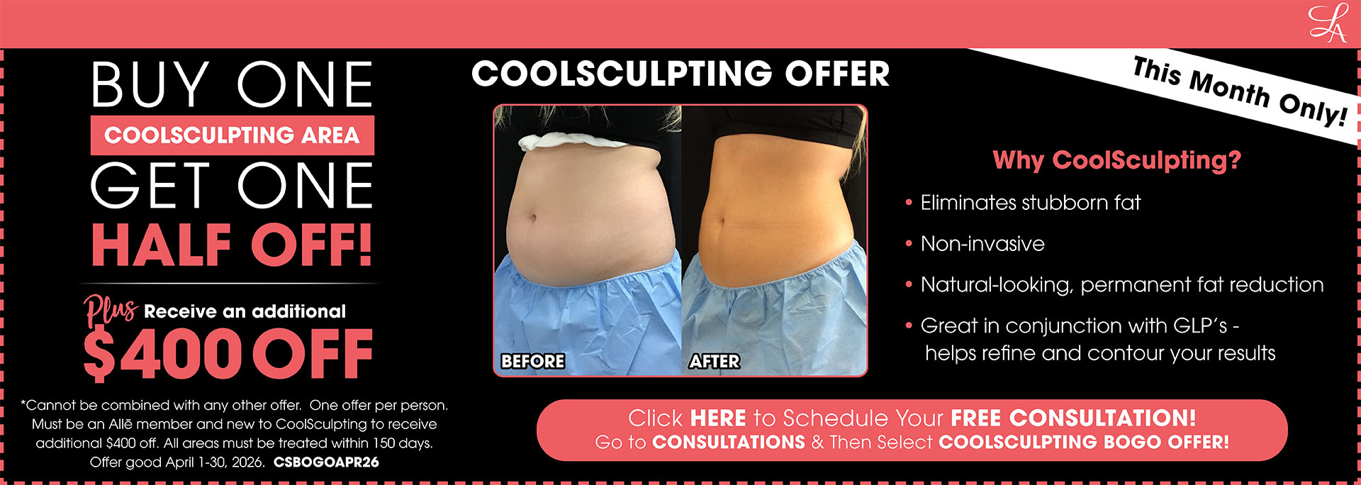 April CoolSculpting Offer