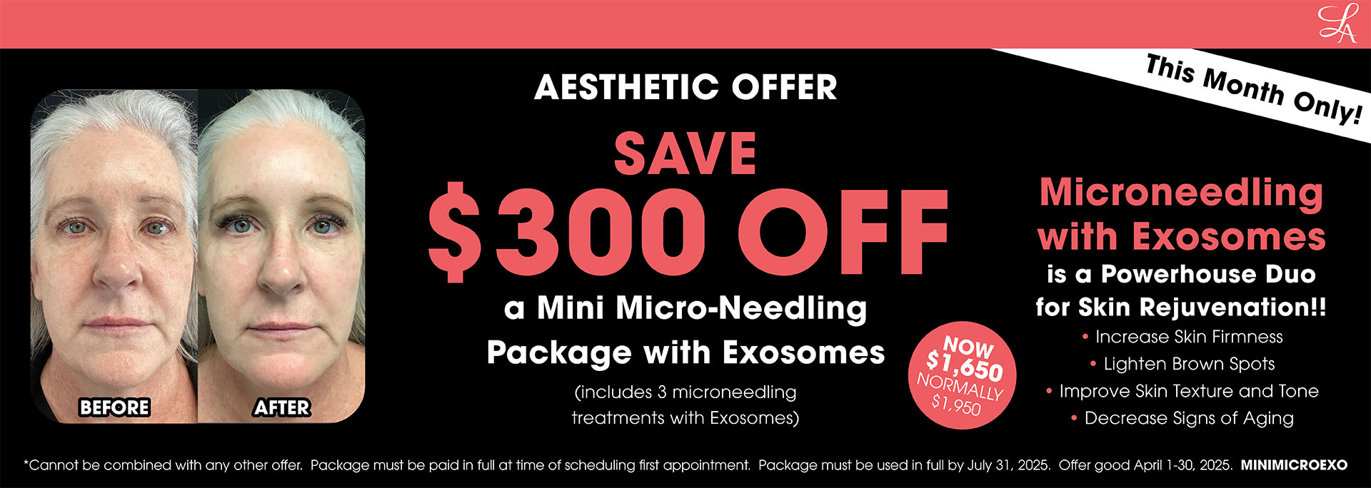 April Offers MicroExo Landing pagev3