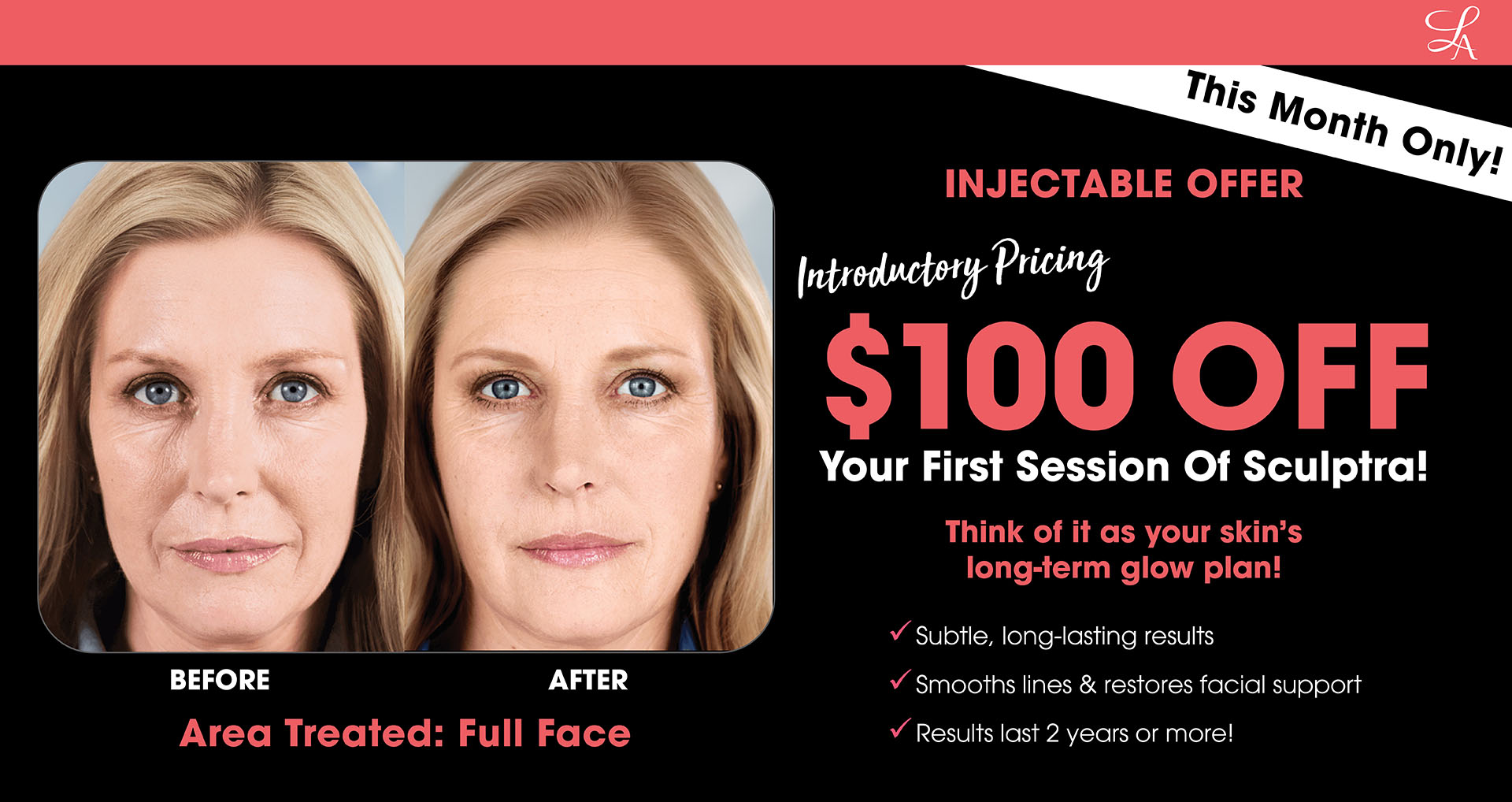 Sculptra Offer!