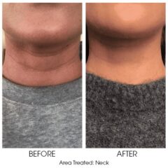 Smooth Threads for Necklace Lines 3