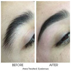 Before and After  - Waxing Eyebrow