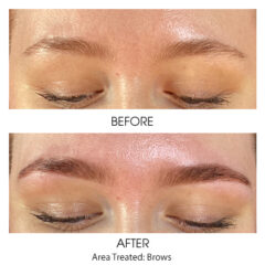Before and After - Brow Stain