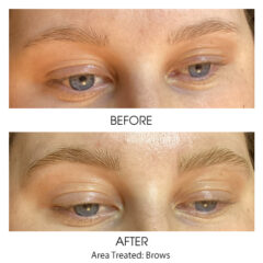 Before and After - Brow Tint