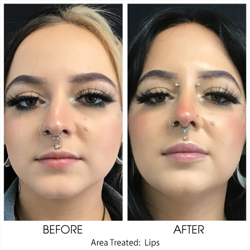 Before + After Gallery: Face