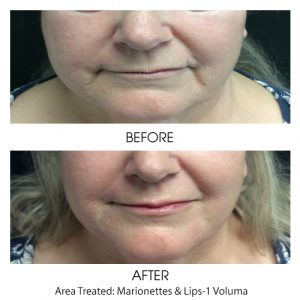 Filler for Marionettes