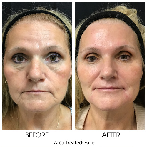 Before + After Gallery: Face
