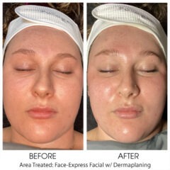 Express Facial wDermaplaning1
