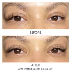 Extensions1-Classic-240x240