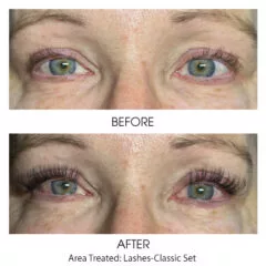 Extensions2-Classic-240x240