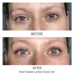 Extensions3-Classic-240x240