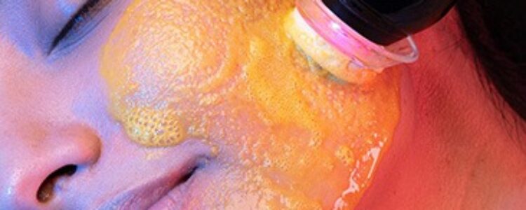 What Is a Glo2Facial? Benefits, Results & Why It Was Named 2026’s Best Facial for Acne