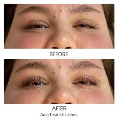 Before and After - Eyelash Lift