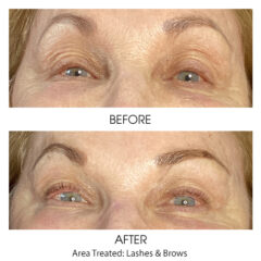 Before and After - Lash and Brow Tint