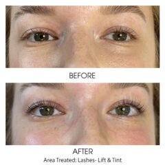 Before and After - Lashes Lift and Tint