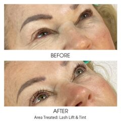 Before and After - Lash Lift and Tint