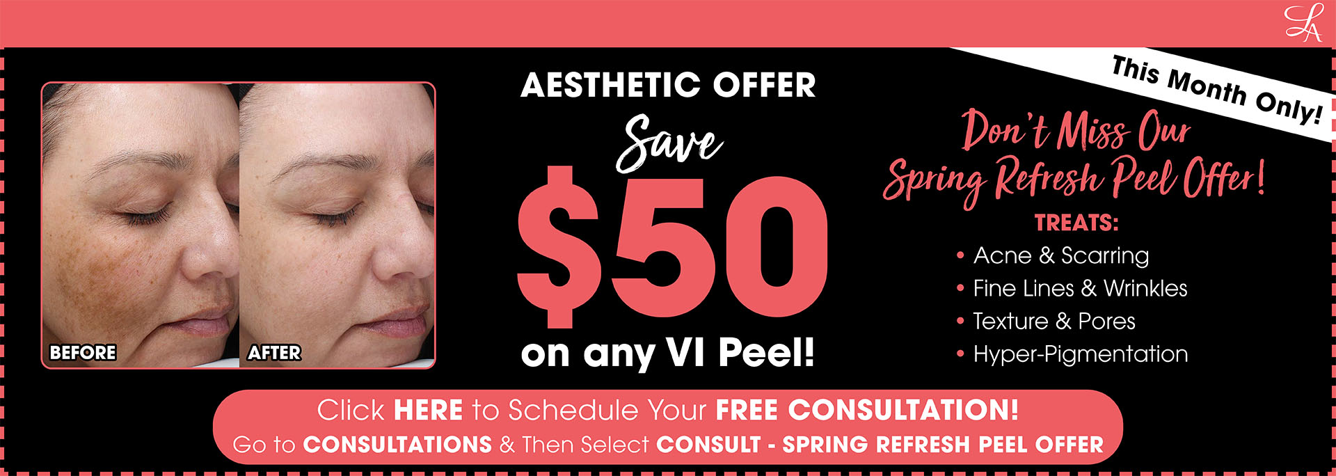 March VI Peel Offer