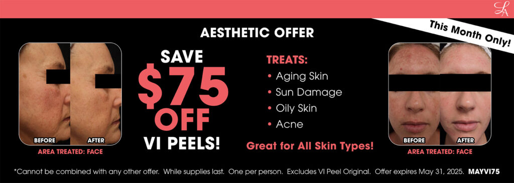 VI Peel Offer