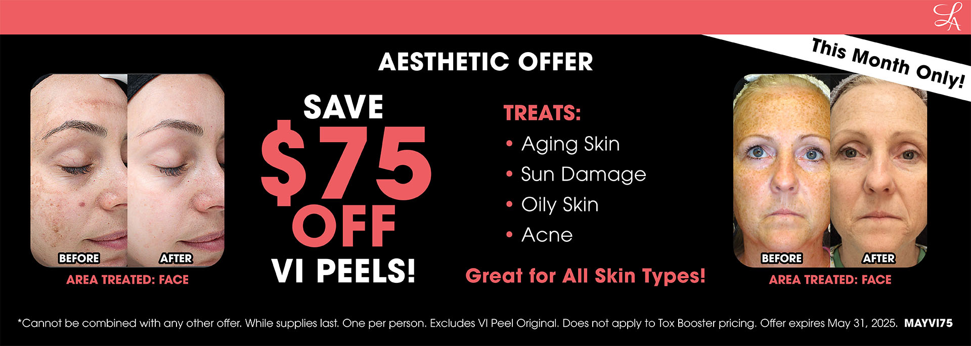 VI Peels