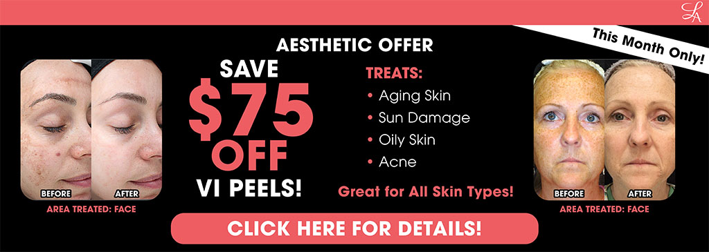 $75 Off Vi Peels