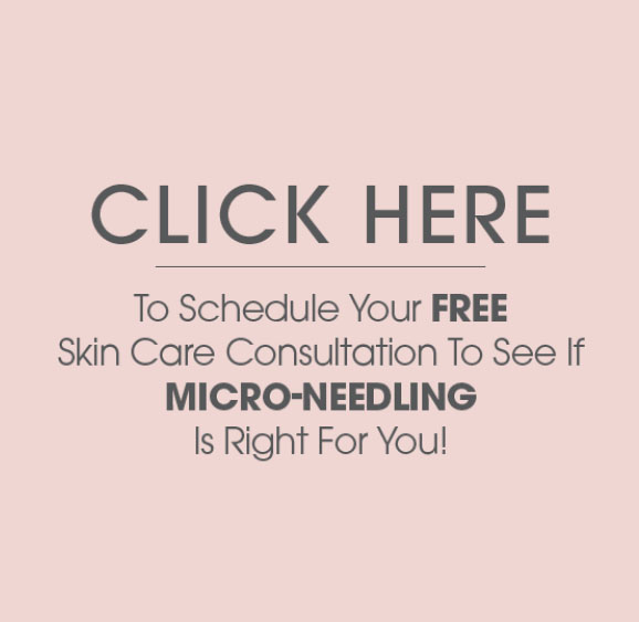 Micro-Needling