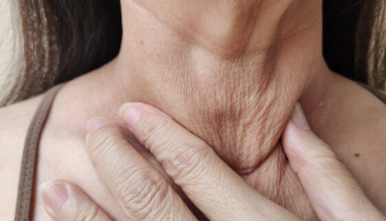 Neck Lines