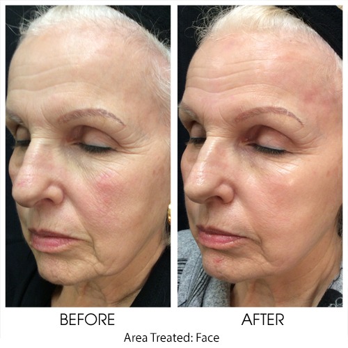 Before and after skin care products treatment of the face