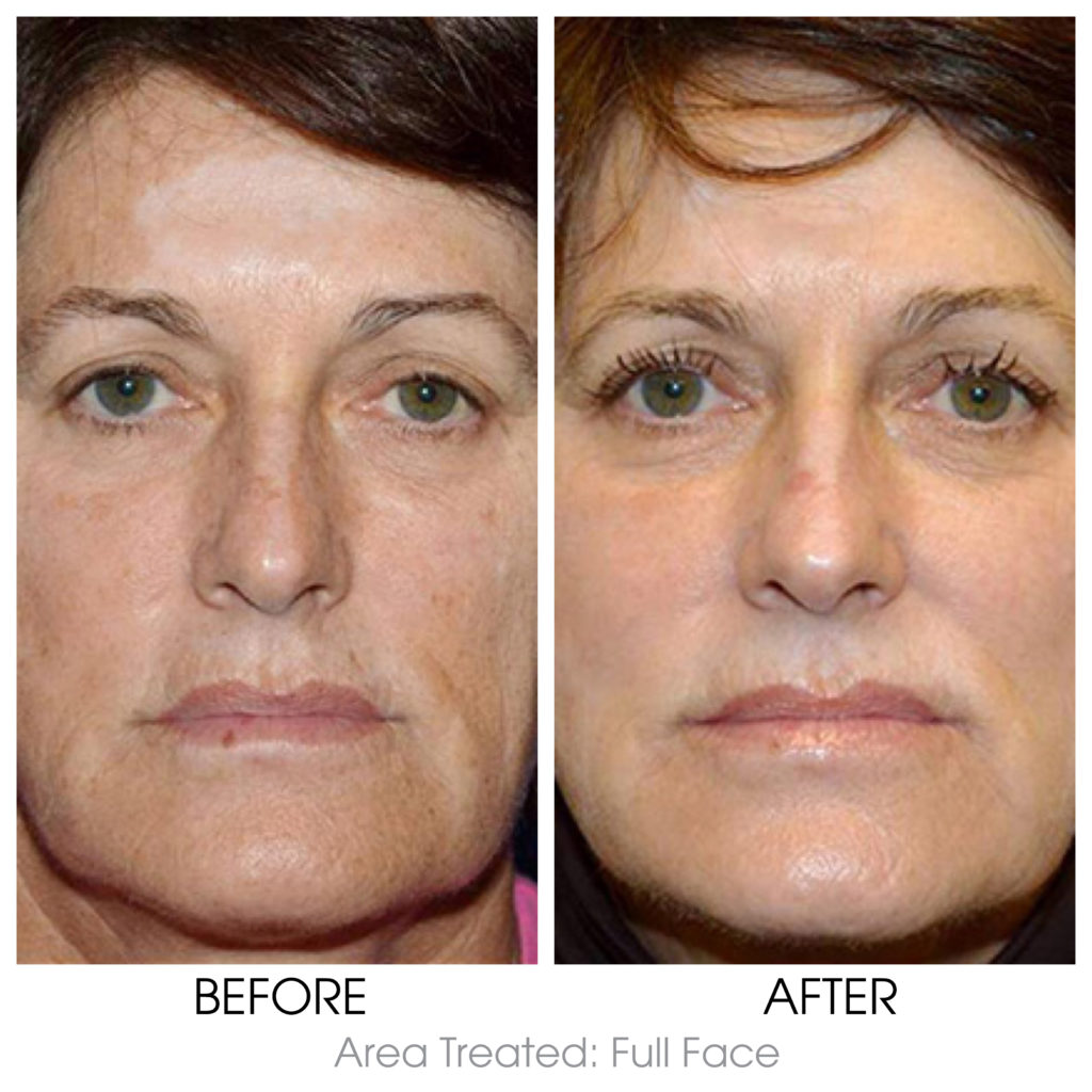 Skin Texture