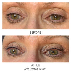 Before and After - Eyelash Tint