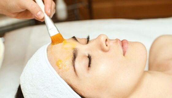 Chemical Peels