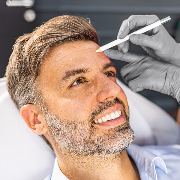 botox consultation
