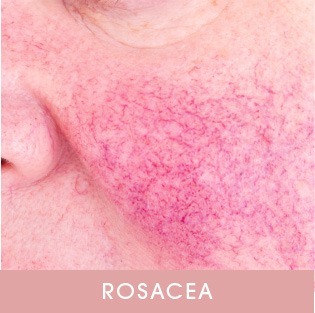 Skin Care Concerns – Face