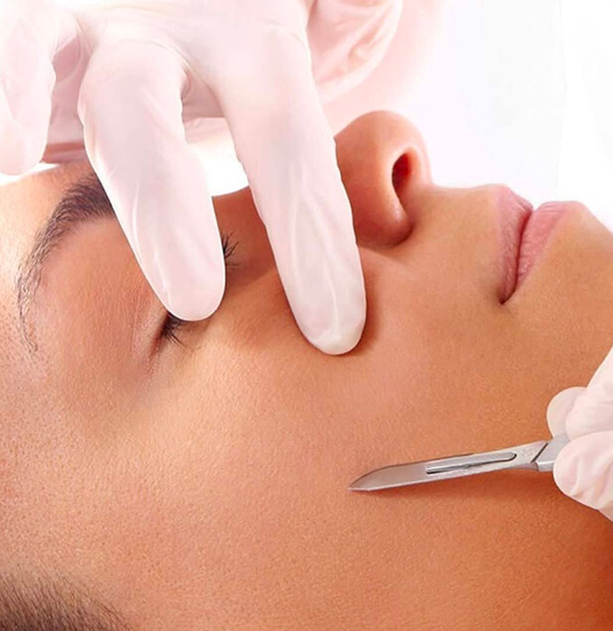 Dermaplaning DERMAPLANING