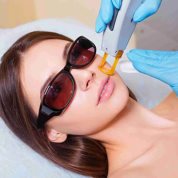 laser-hair-removal-upper-lip