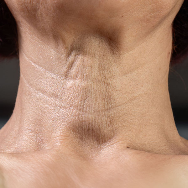 neck4