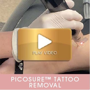 Procedure Videos