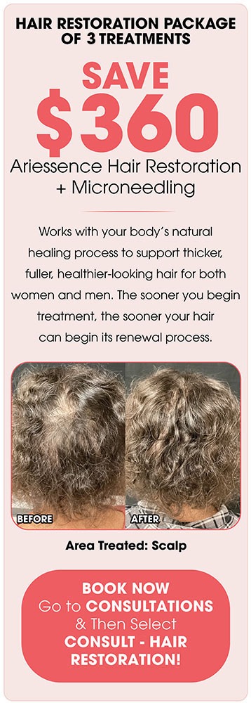 Ariessence Hair Restoration  + Microneedling