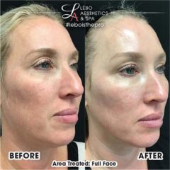 SkinVive Results