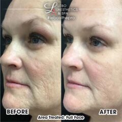 SkinVive Pictures