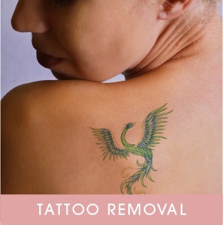 Unwanted Tattoos