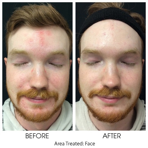thumbnail_image011 Skin Care Products for Men