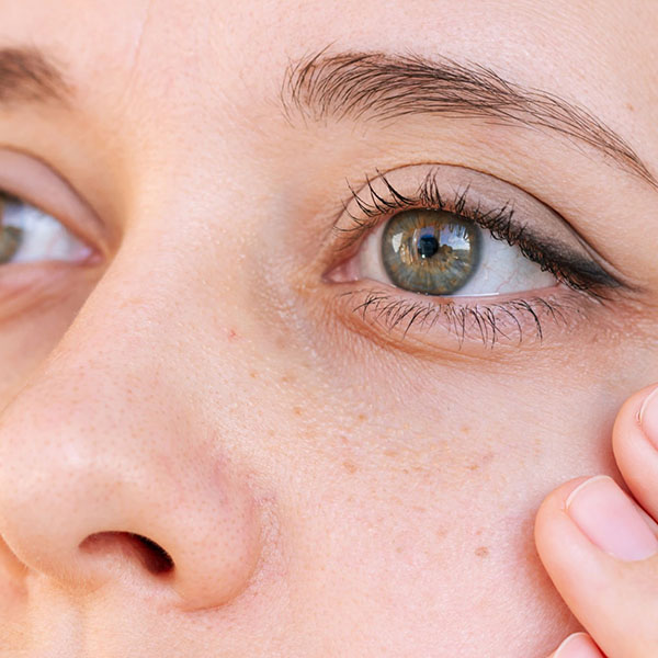 Under Eye Rejuvenation Treatment 4